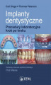Okładka książki: Implanty dentystyczne. Procedury laboratoryjne krok po kroku